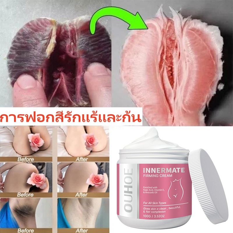 ครีมทาผิวขาว ครีมบำรุงรักแร้ ครีมไวท์เทนนิ่ง 100g 7 วันเห็นผล ครีมขาหนีบดำ ครีมหัวนมชมพู ทาที่ลับขาว ลบเมลานิน