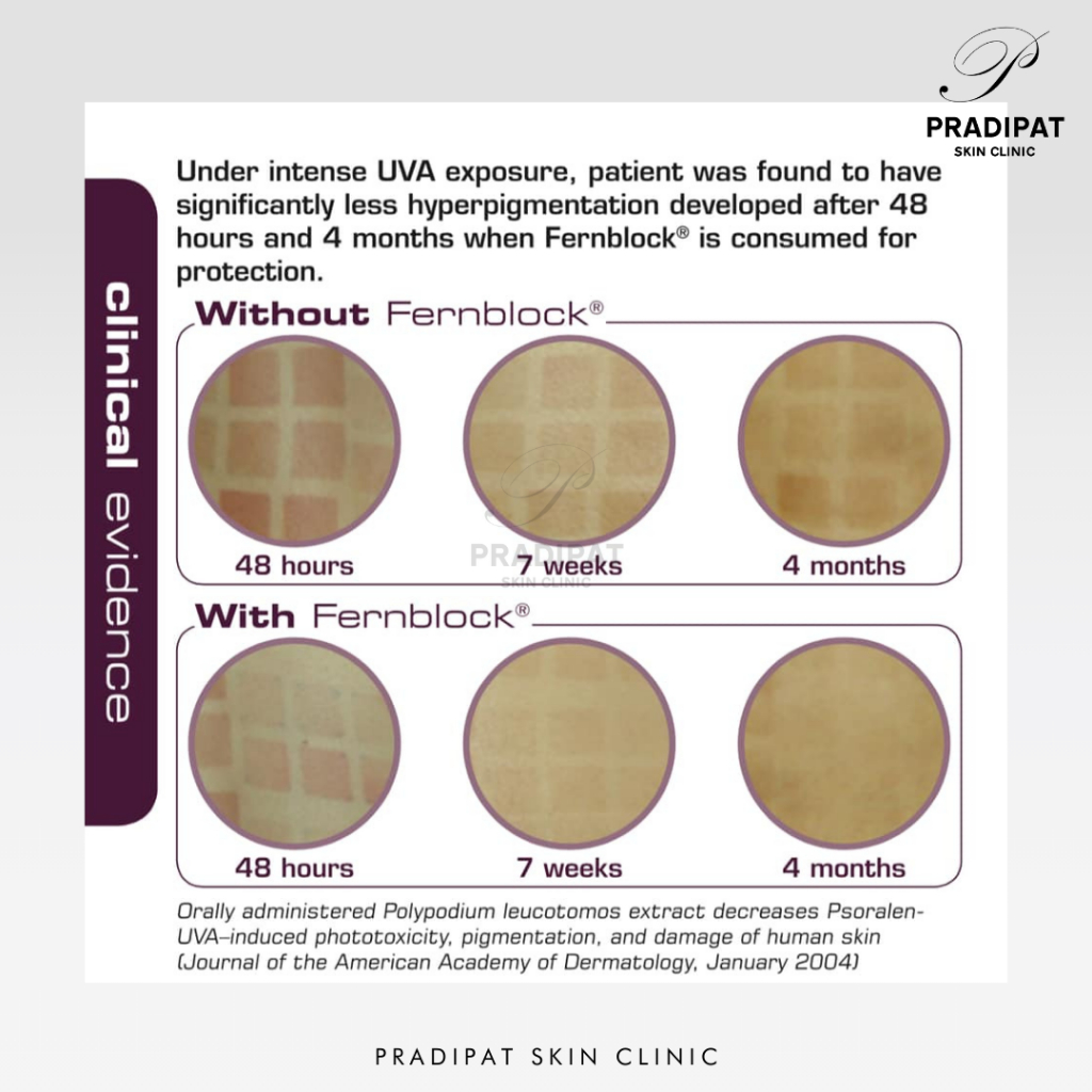 Heliocare PUREWHITE RADIANCE Max 240 วิตามินกันแดด เพื่อผิวขาวกระจ่างใส ลดฝ้า รอยดำ (จำหน่ายเฉพาะในโรงพยาบาลและคลินิก) ราคา ถูกที่สุด ดีลบีเคเค แกลเลอรีภาพที่ 8