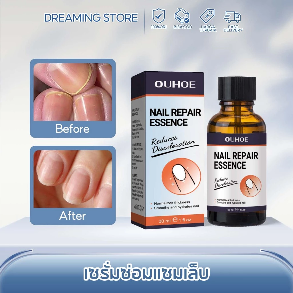 OUHOE เซรั่มเล็บ เชื้อราเล็บมือ Nail Care เซรั่มบำรุงเล็บ เซรั่มซ่อมแซมเล็บ และเล็บขบ บำรุงเล็บเสีย