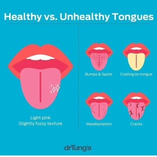 drTung's Tongue Cleaner | ที่ทำความสะอาดลิ้น 1 pcs รุ่นสแตนเลส ( คละสี )