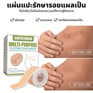 South Moon รักษารอยแผลเป็น แผ่นแปะแผลเป็น กําจัดรอยแผลเป็นจากแผลเป็น เผยผิวเนียนสวย
