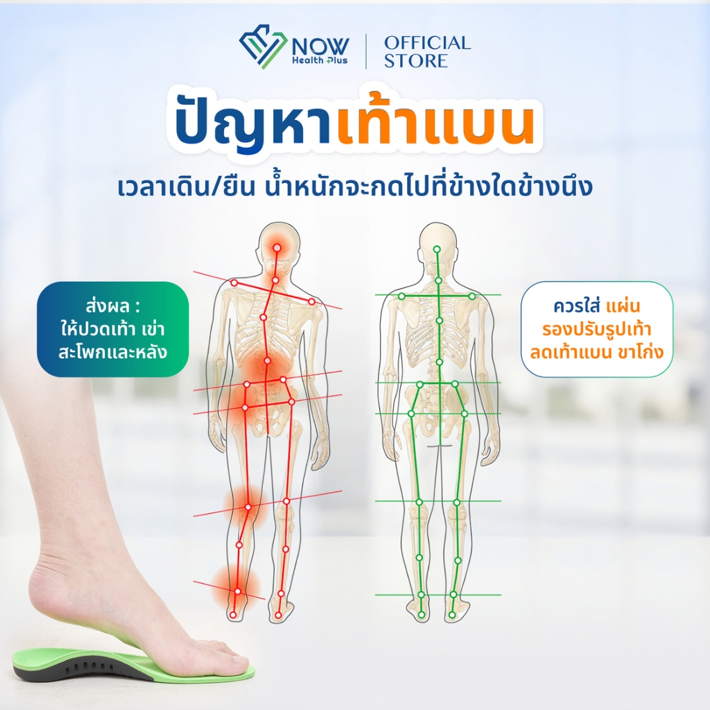 NOWHealthPlus+ แผ่นรองปรับรูปเท้า ลดเท้าแบนขาโก่ง - รูปที่ 4