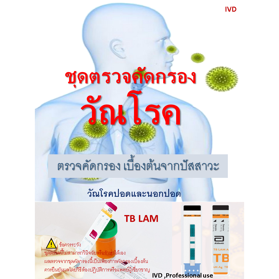 ชุดตรวจคัดกรองวัณโรคจากปัสสาวะ เบื้องต้น TB LAM  (Professional use)ทะเบียน อย.65-2-2-1-00044190