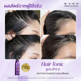 [1แถม1] DAENG GI MEO RI JINGI Anti-Hair Loss Scalp Hair Tonic จินจิ แอนตี้ แฮร์ ลอส สคัลพ์ แฮร์ โทนิค เซรั่มลดผมร่วง