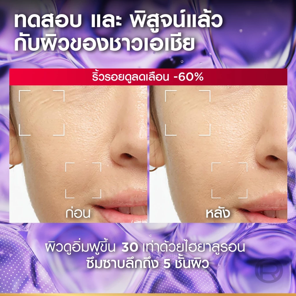 L'Oréal Paris Revitalift Hyaluronic Acid Serum 30ml แพ็กคู่ thumbnail 5