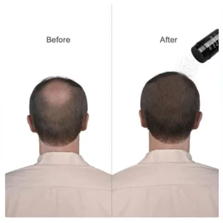 *พร้อมส่ง* DeXe Hair Building Fibers ผงไฟเบอร์เพิ่มผมหนา ปิดผมบาง