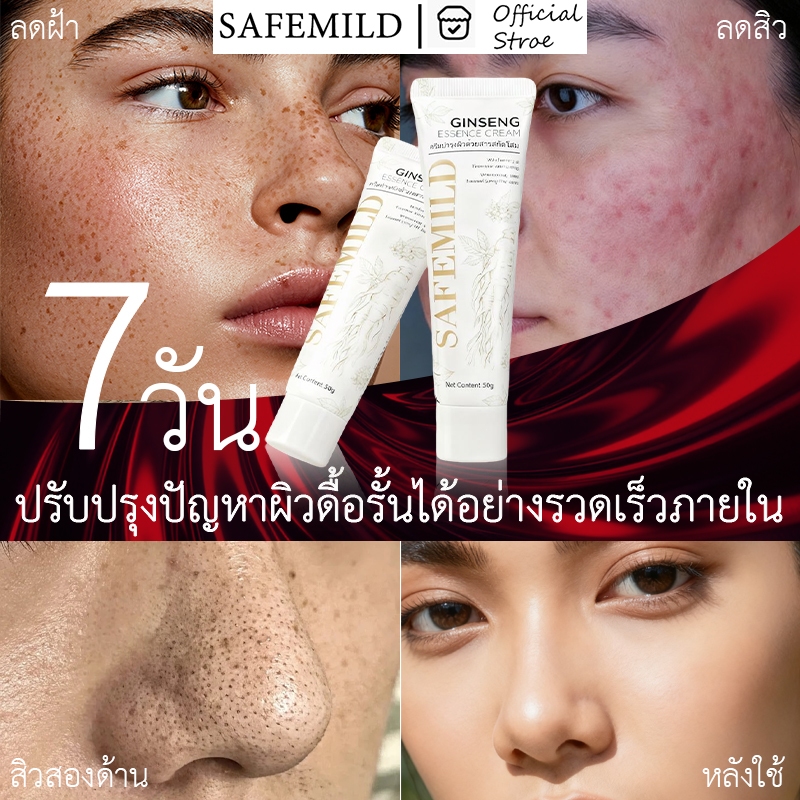 ลบสิว💖SAFEMILD Whitening body lotion โลชั่น ผิวขาว บำรุง กระจ่างใส ขาวเร็ว ขาวไว ดำ ผิวคล้ำ ผิวกาย