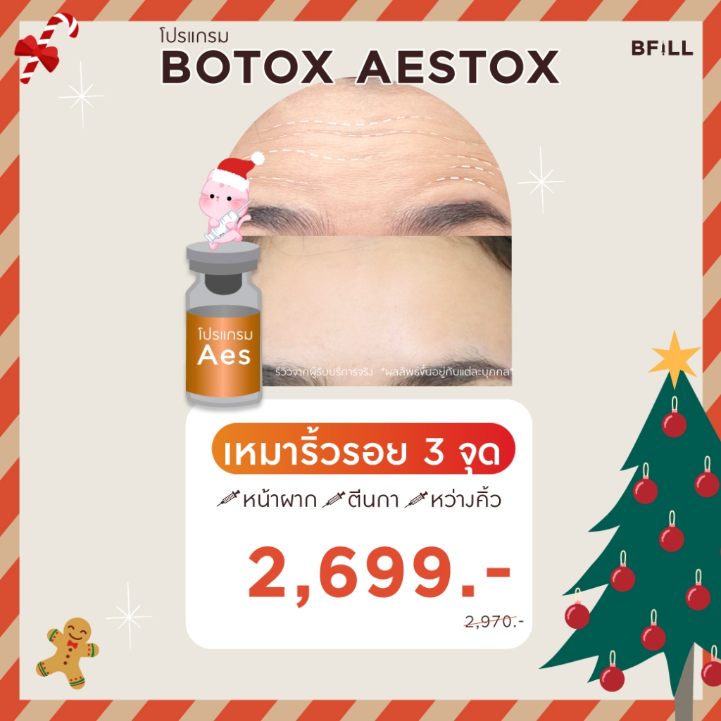 โปรแกรม Botox (Aestox) Wrinkles โบท็อก ริ้วรอย ตีนกา หว่างคิ้ว ริ้วรอยหน้าผาก โบปีกจมูก
