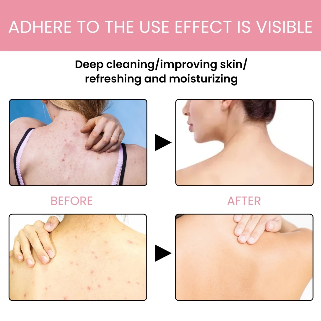 EELHOE สบู่คาร์บอน Carbon-Mud Back Soap thumbnail 6