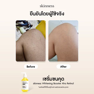 [หลายขวดคุ้ม] skinness whitening booster aha retinol | เซรั่มผิวกายใสเต่งตึง