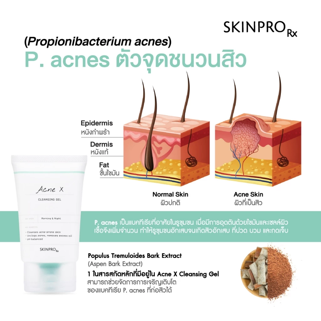 ขายดีอันดับ 1 SKINPRO Rx Acne X Cleansing Gel 50ml คลิ่นซิ่งเจลสูตรสำหรับผิวมัน/เป็นสิว ลดการเกิดสิว thumbnail 7