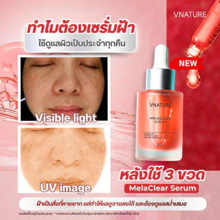 เซรั่มฝ้า Melaclear Serum Vnature วีเนเชอร์ เซรั่มฝ้ากระ จุดด่างดำ ผิวแพ้ง่าย หน้าใส 30ml.