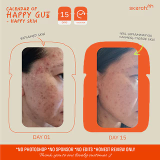 เซตอวสานวงจรสิว แถม! เชคเกอร์ [30 วัน - 2 กล่อง] โพรไบโอติก SKARCH PRO+ สิวเรื้อรัง แก้ท้องผูก ผิวใส Pre+Pro+Postbiotic