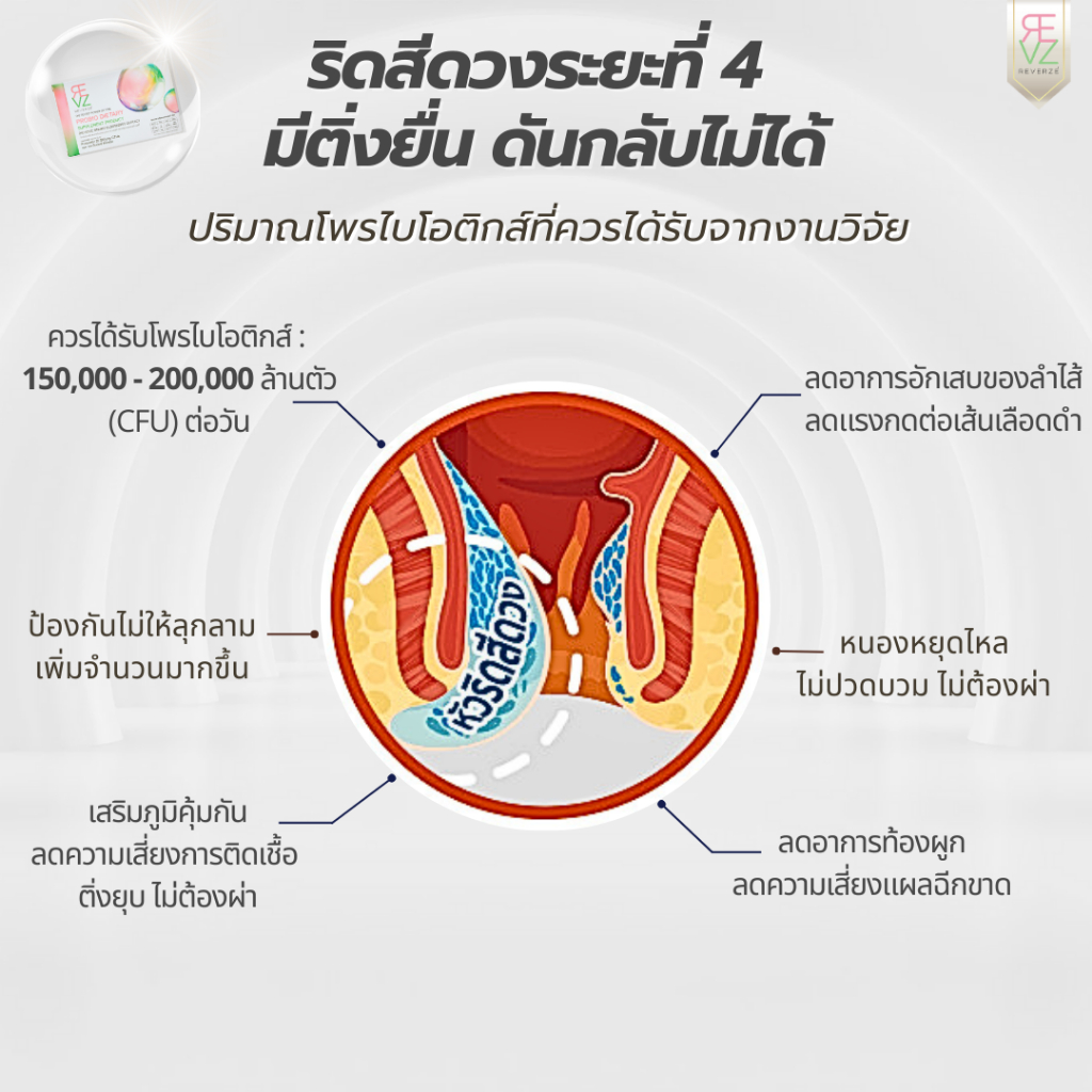 รีเวอร์เซ่ By รีเวร่า โพรไบโอติก พลัส เอลเดอร์เบอร์รี่ ผลิตและคิดสูตรโดยแพทย์นักวิจัยเยอรมนี  2กล่อง - รูปที่ 7