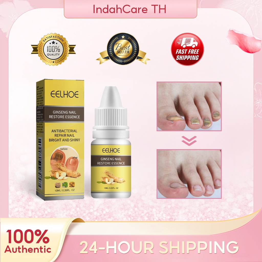 EELHOE Ginseng Nail Oil 10ml Healthier Nails With Nourishing And Repairing Properties Antifungal