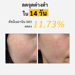 Spring Letter Toner Pad แผ่นเช็ดหน้า VC ลดจุดด่างดำ ขาวใส ละลายฝ้า จุดด่างดำ กระ ฝ้า จุดด่างดำ จางลง สำหรับผิวบอบบาง