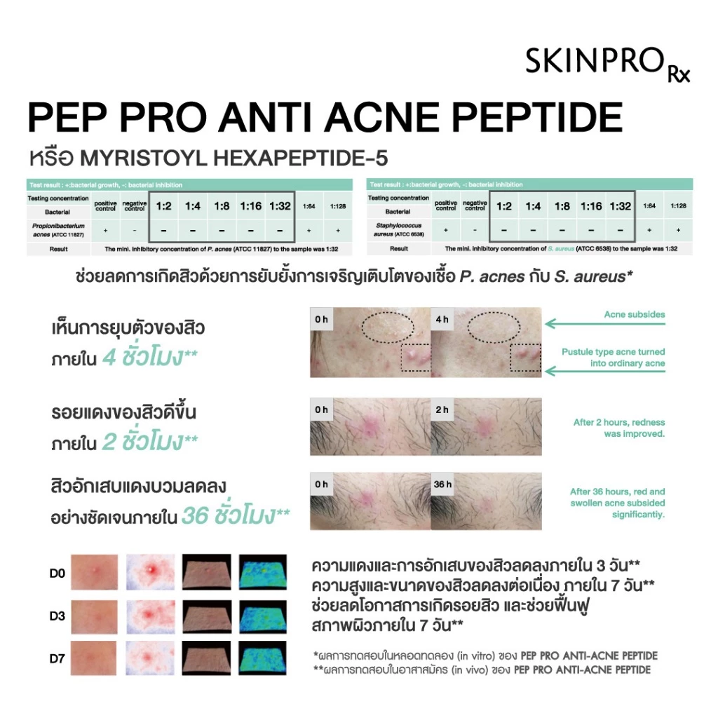 SKINPRO Rx Acne X Spot Gel 6ml เจลแต้มสิว ยุบไว ลดปัญหาสิวได้อย่างตรงจุด thumbnail 7