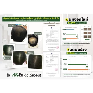 AloEx Organic Hair Serum 120 ml. ขวดใหญ่ เซรั่มบำรุงหนังศีรษะและเส้นผม ลดผมร่วง สร้างผมใหม่ รากผมแข็งแรง เพิ่มผมหนา
