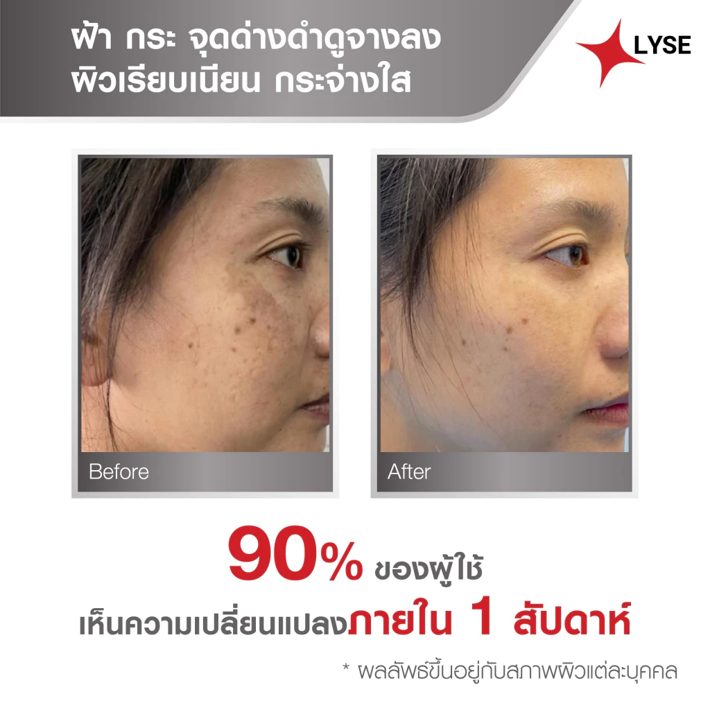 เซตหน้าโกลว์ LYSE เซรั่มเมลาสม่า 30ml กันแดด 30ml สบู่อเมทิสต์ 70g thumbnail 4