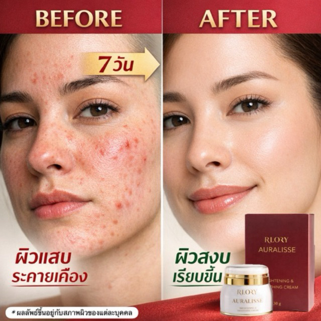 RLORY AURALISSE brightening&smoothing cream ลอรี่ ครีมอับดับ 1 ผิวหน้ากระจ่างใส สิว ฝ้า รอยดำ จางลง ผิวนุ่มชุ่มชื้น