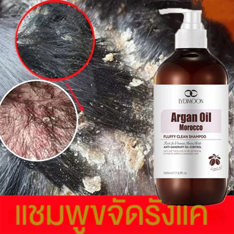 LYDIMOON ยาสระผมขจัดรังแค แชมพูรังแค ยาสระผม 500ML แชมพูแก้คันหนังศรีษะ ขจัดรังแค บํารุงรากผม แชมพูรังแค shampoo