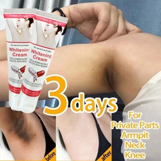 ครีมรักแร้ขาว ครีมทาผิวขาว ครีมทาคอให้ขาว ทำให้เมลานินในรักแ…