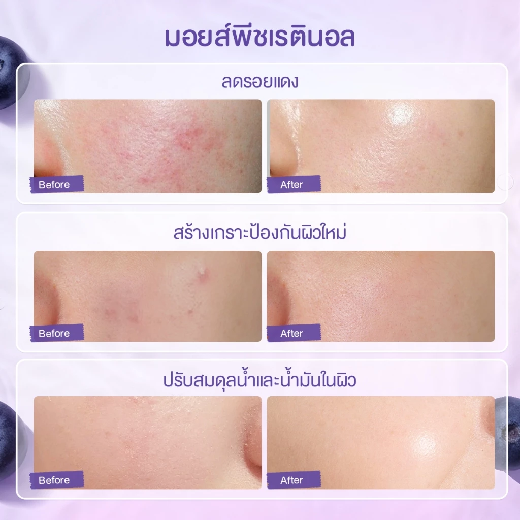 【Proxie's Pick】Glad2Glow Blueberry Ceramide Moisturizer มอยเจอร์ไรเซอร์ ครีม ครีมทาหน้า สกินแคร์ thumbnail 8