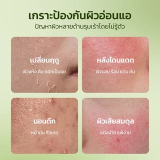 Bodana ครีมทีทรี ซื้อ 1 แถม 1 บำรุงผิวให้ชุ่มชื้น ลดสิว ควบคุมความมัน บรรเทาผิวแดง ผิวแพ้ง่ายใช้ได้