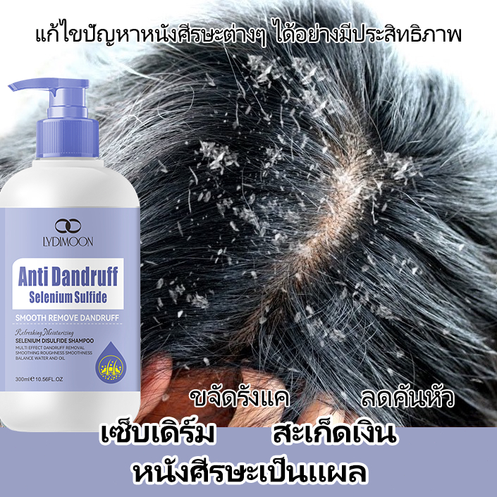 แชมพูขจัดรังแค แชมพูรังแค ยาสระผมขจัดรังแค ขจัดปัญหารังแคและลดความคันบนหนังศีรษะ ยาสระผมรังแค กำจัด เชื้อราบนหนังศรีษะ
