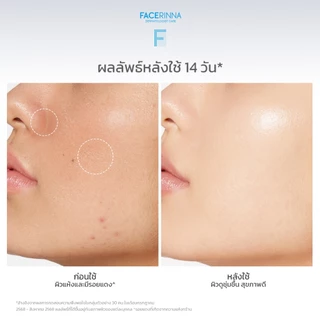 [Facerinna official] Ceramide B5 Balancing Moisturizer ครีมบำรุงผิว ฟื้นฟูผิว เสริมสร้างผิวแข็งแรง ล็อกความชุ่มชื้นa