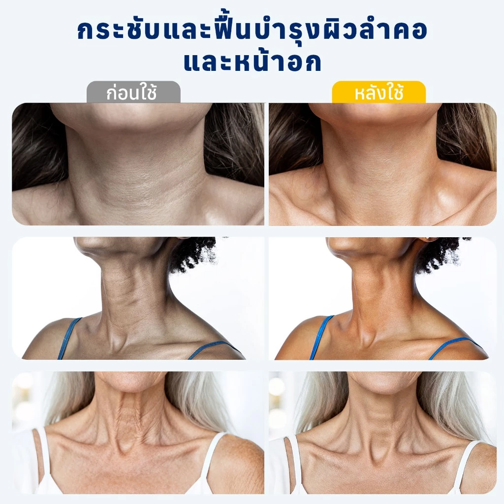 Z:SEA ครีมทาคอและเนินอก กระชับผิว พร้อมลูกกลิ้ง 100ml ลดเลือนริ้วรอย ชะลอวัย ผสานเปปไทด์ คอลลาเจน ไฮยาลูรอน วิตามิน B5 thumbnail 9