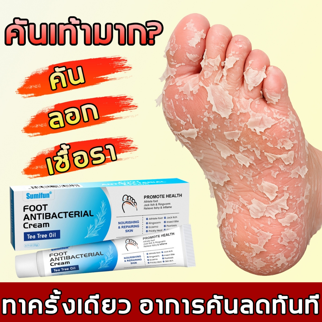 ฆ่าเชื้อโรค ครีมระงับกลิ่นเท้า ครีมทาเท้า บรรเทาคัน ป้องกันเชื้อรา ฟื้นฟูผิวเา ครีมลดกลิ่นเท้า