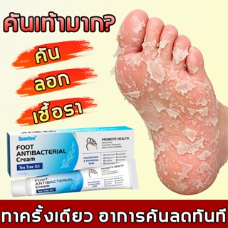 ฆ่าเชื้อโรค ครีมระงับกลิ่นเท้า ครีมทาเท้า บรรเทาคัน ป้องกันเ…