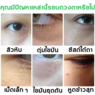 VIVX เม็ดไขมัน 30ml ลบคล้ำบวมใต้ตา กระชับรอยตีนกา ลดเม็ดไขมัน ฟื้นฟูผิวตา ครีมทารอบดวงตา เซรั่มอายครีม อายครีม