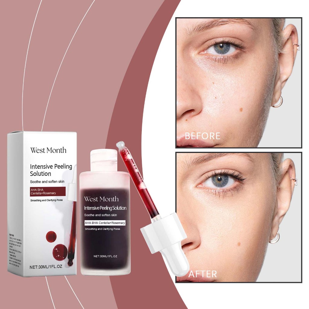 West Month เซรั่มหน้าขัดผิว AHA BHA PHA 30ml ขัดขี้ไคล Facial Serum เซรั่มบำรุงผิวหน้า ผิวกระจ่างใส