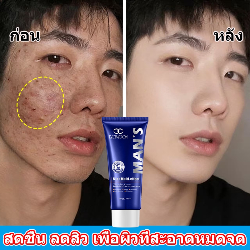 โฟมล้างหน้าสูตรอ่อนโยนสำหรับผู้ชายมีส่วนผสมของกรดอะมิโนช่วยควบคุมความมันขจัดสิวทำความสะอาดรูขุมขนบำรุงและให้ความสดชื่น