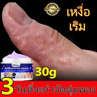 🔥แก้คัฆ่าเชื้อ🔥ครีแก้คัน คันเรื้อง เชื้อรา คันใมผ้า ขาหนีบ เชื้อรา ผื่นกัด Anti-itch cream