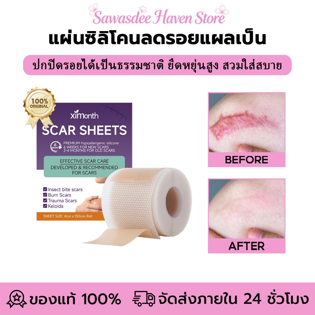 Ximonth รักษารอยแผลเป็น แผ่นแปะแผลเป็น รอยแผลเป็น กําจัดรอยแผลเป็นจากแผลเป็น เทปเจลแผลเป็นไหม้