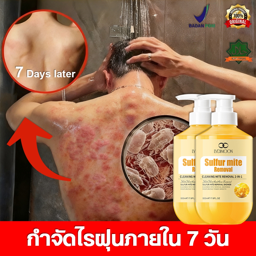 LYDIMOON เจลอาบน้ำป้องกันไรฝุ่นกำมะถัน 500ml  กำจัดไรลดสิว ต้านเชื้อราแก้คันคุมน้ ทำความสะอาดผิว ให้