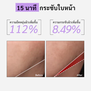 Spring Letter Toner Pad แผ่นมาส์กVC ขนาดพกพา ลดริ้วรอย ยกกระชับผิว เพิ่มความยืดหยุ่น ผิวกระจ่างใส ผิวกระชับ หน้าเต่งตึง
