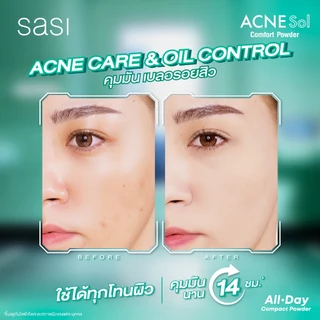 sasi ศศิ แอคเน่ โซล คอมฟอร์ท พาวเดอร์ Acne Sol Comfort Powder (4.5g)