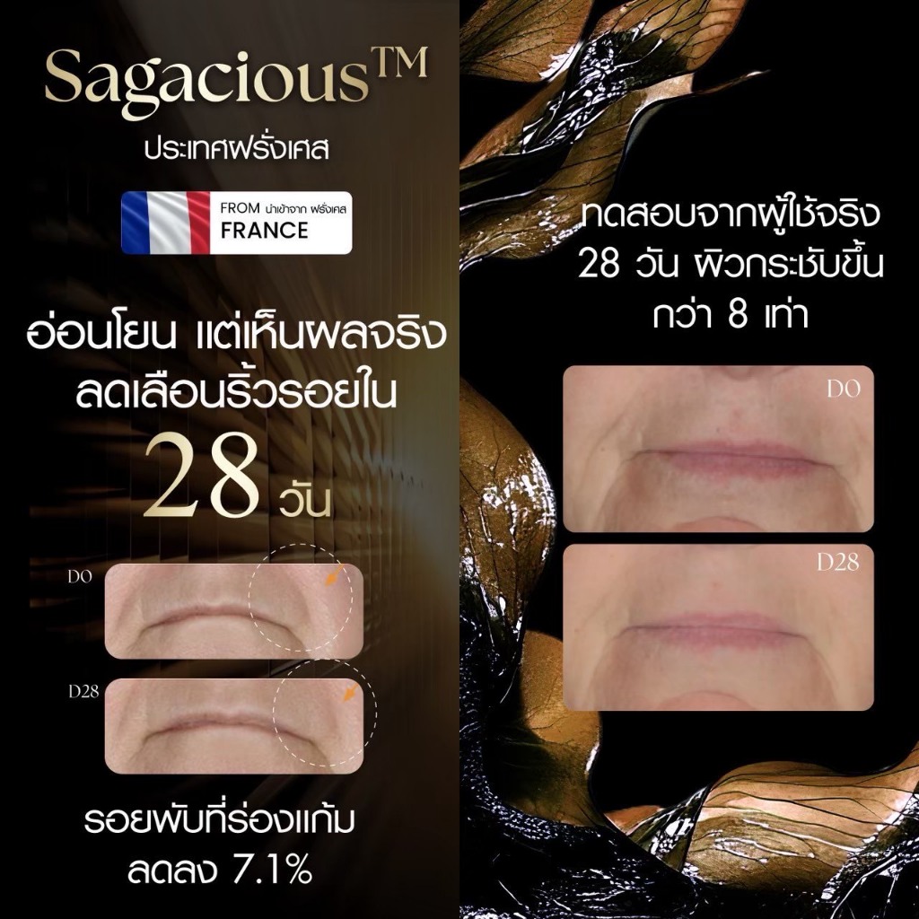 ร้านค้าบริษัท Q Russ Premium Mask มาส์กหน้าทองคำ ผิวชุ่มชื้น เนียนเด้ง ดูสุขภาพดี — صورة 5
