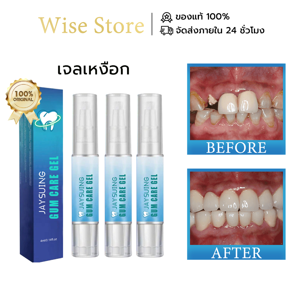 Jaysuing เจลเหงือก ปากกาเจลฟอกสีฟัน ฟอกฟันขาว ซ่อมแซม ลดอาการไม่สบายเหงือก Teeth whitening