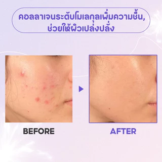 🎁ซื้อ 3 แถม 1🎁 ให้คอลลาเจนชะลอริ้วรอยแห่งวัย ลดเลือนริ้วรอยรูขุมขน SEYOUL Collagen Peeling Mask 50ml