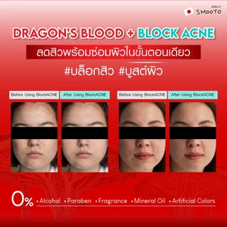 SMOOTO Official สมูทโตะ ดราก้อน บลัด แอคเน่ ไบร์ท บูสเตอร์ เจล (กล่อง) รหัส SMT183 / กล่อง
