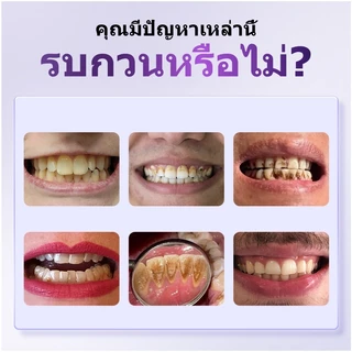 ซื้อ1แถม2🔥 YOOMU ยาสีฟันสีม่วง ฟอกฟันขาว ลดคราบกาแฟ บุหรี่ ชา ลดกลิ่นปาก ป้องกันฟันผุ อ่อนโยน