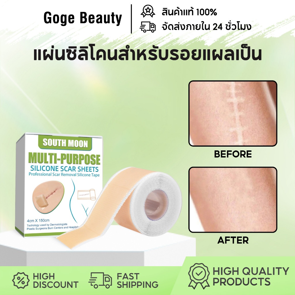 South Moon รอยแผลเป็น Silicone Scar Sheet 4cm×150cm แผ่นแปะแผลเป็น ซิลิโคน การลบรอยแผลเป็น กันน้ำ