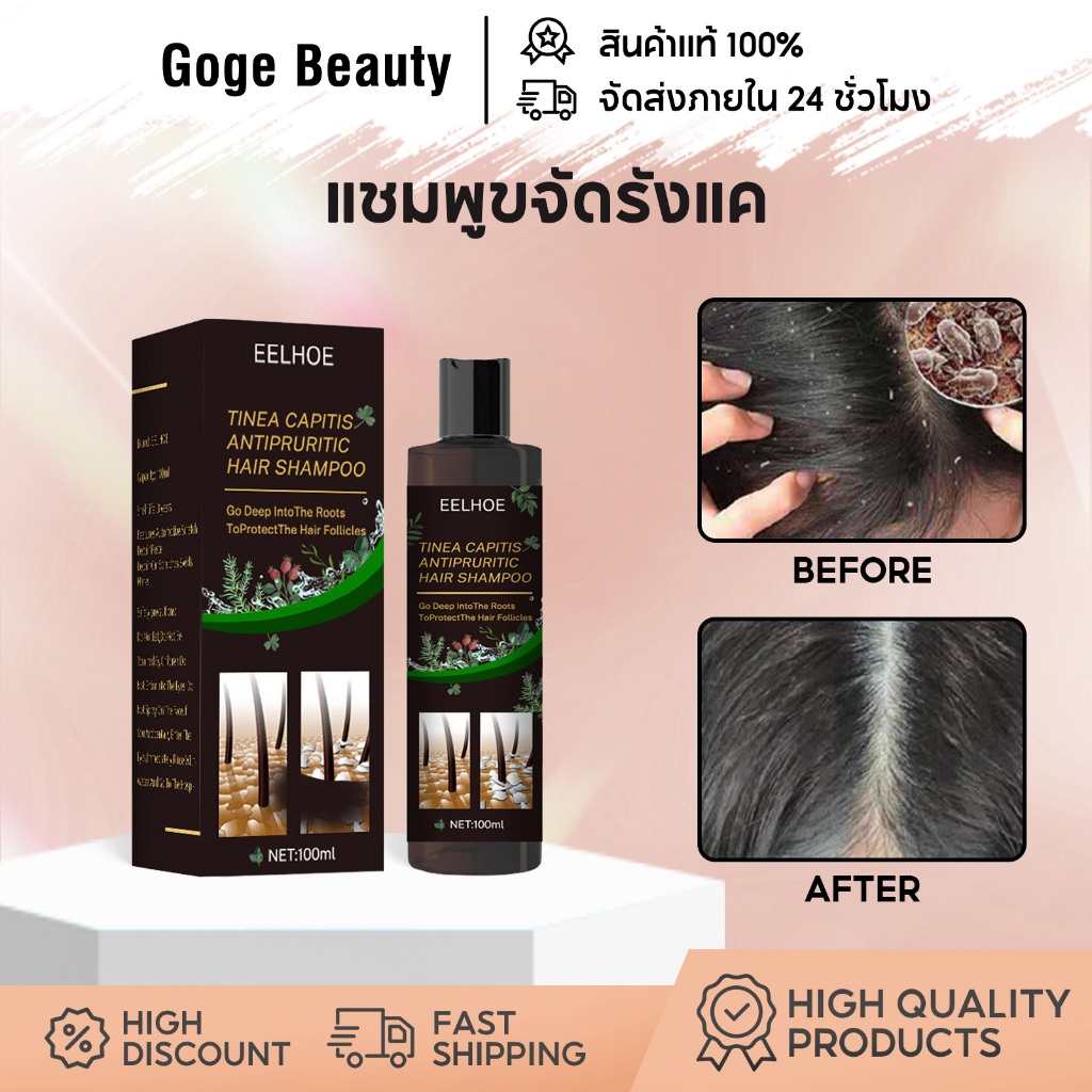 EELHOE แชมพูขจัดรังแค แชมพูคัน 100ml ขจัดรังแค หยุดอาการคัน บำรุงเส้นผมและหนังศีรษะ