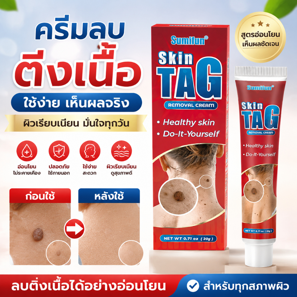 Sumifun Skin Tag Removal Cream ครีมดูแลผิว เนื้อบางเบา ใช้งานง่าย เหมาะสำหรับผู้ที่ต้องการดูแลผิวบริเวณที่มีติ่งเนื้อหรื