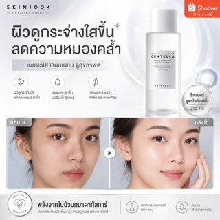 SKIN1004 โทนเนอร์ 210ml. มีหลายสูตรให้เลือก เนื้อบางเบาซึมไว สูตรอ่อนโยน ลดแดง ปลอบประโลมผิวแพ้ง่าย เหมาะกับทุกสภาพผิว